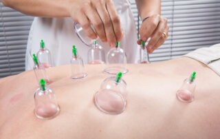 Benefits Cupping Therapy In Southlake, Texas