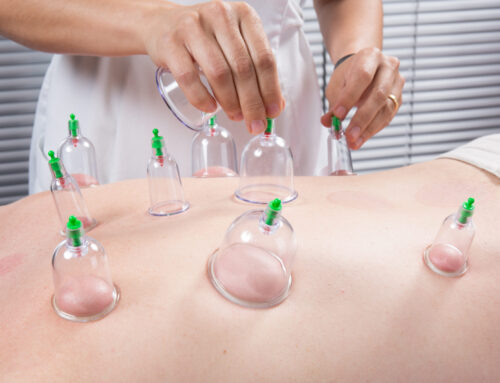 Benefits Cupping Therapy In Southlake, Texas